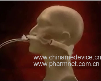 一次性使用经口鼻导管插管固定器