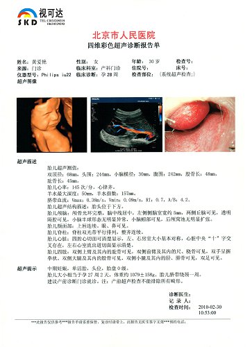 医用B超胶片