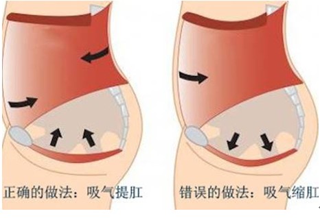 顺产后下面松弛怎么办 5种缓解产后松弛方法介