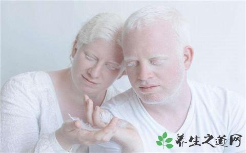 重大疾病保险白化病赔吗 白化病可以买重疾险吗